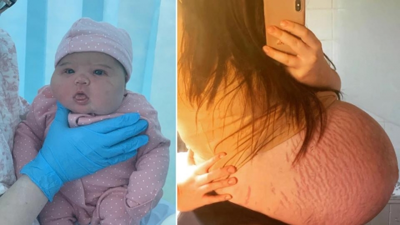 Девушка родила &laquo;гигантского&raquo; ребенка и удивила врачей