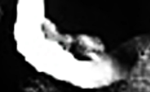 &laquo;Инопланетные сооружения&raquo; на Луне обнаружил уфолог