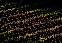 Ученые восстановили активность мозга свиньи через час после остановки сердца