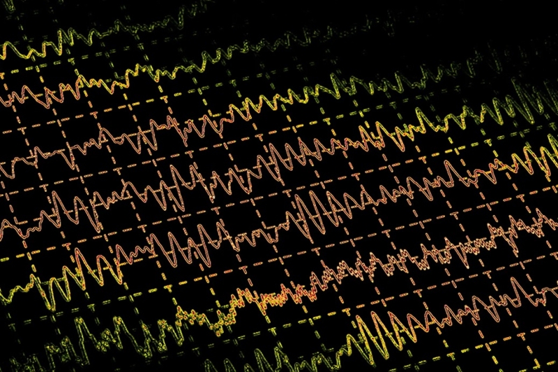 Ученые восстановили активность мозга свиньи через час после остановки сердца