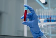 Какие анализы показывают уровень гемоглобина и когда их нужно сдавать?