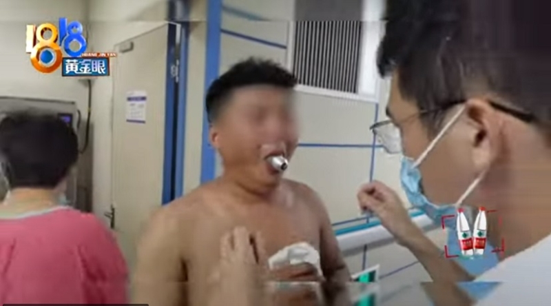 Китаец попал в больницу с застрявшей во рту лампочкой