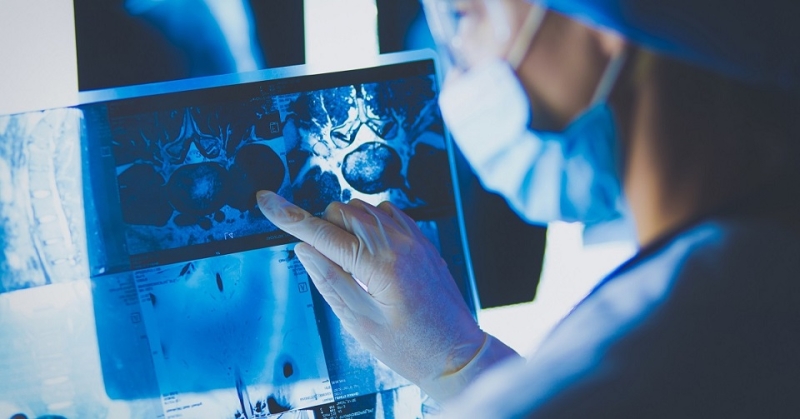 Как старение влияет на риск развития рака, выяснили ученые