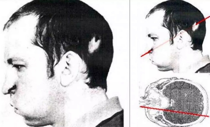 Необычный случай: Как советский учёный пережил смертельную дозу радиации