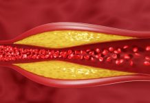 Китайские ученые разработали нановакцину против сердечно-сосудистых заболеваний