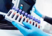 Учёные обнаружили новую группу крови — самую редкую в мире