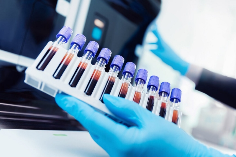 Учёные обнаружили новую группу крови &mdash; самую редкую в мире