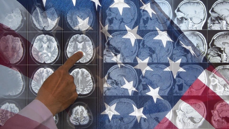 Эксперты США назвали вероятную причину &laquo;гаванского синдрома&raquo;